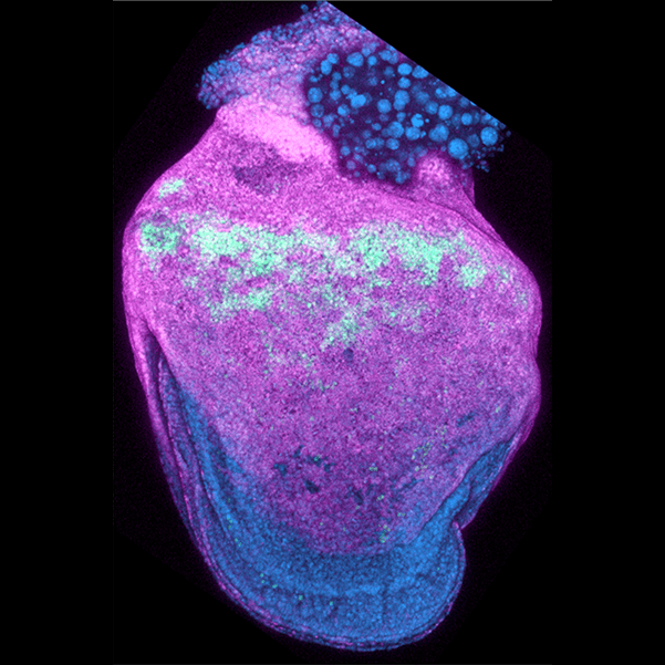 A mouse embryo inside its yolk sac, fluorescence microscopy