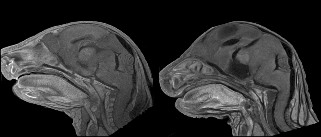 Mouse brain scans, Parchem Lab